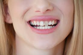 The causes, treatments, and avoidance of stains and discoloration on Teeth